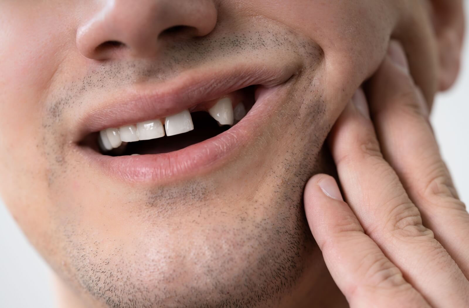 A close-up of an adult with a visible missing tooth gently touching their cheek in a well-lit setting emphasizing dental care.