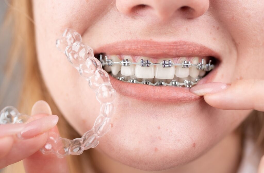 A close up of a smile with braces, while the person holds an Invisalign clear aligner up, symbolizing choosing between the two options.