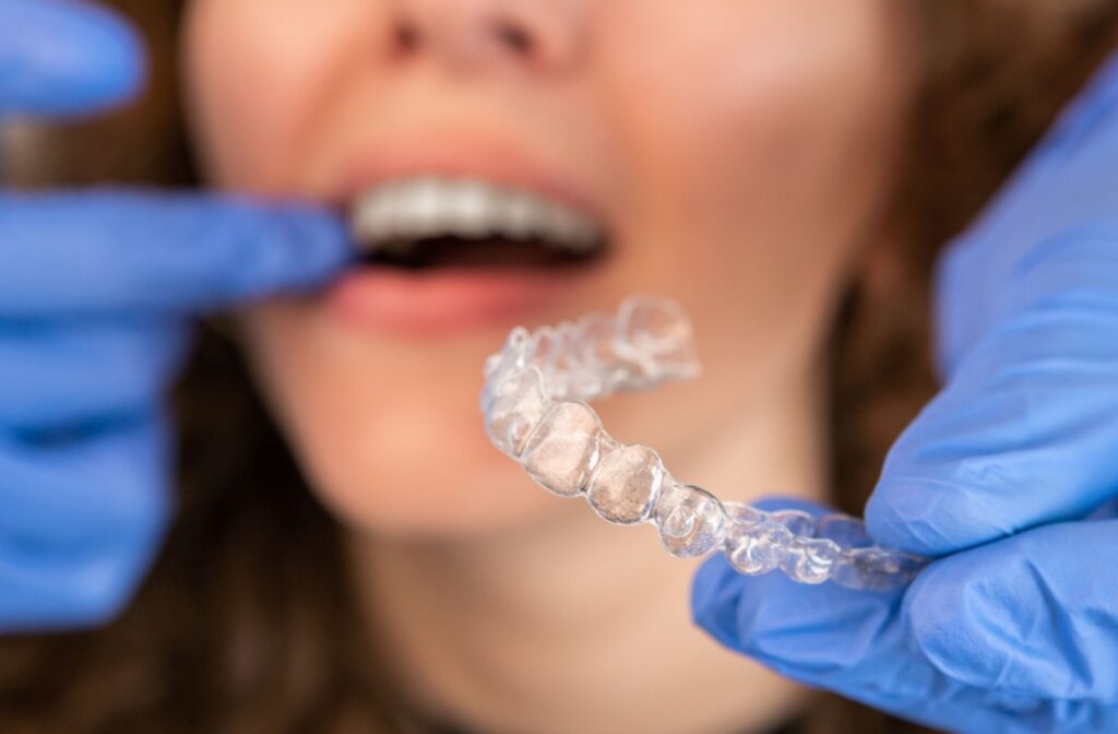 A dentist about to insert an Invisalign aligner into a orthodontic patient's mouth.